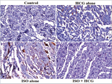 Immunohistochemistry staining patterns of apoptosis marker  p53 protein