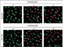 Cirsilineol induced apoptosis in gastric cancer cells in vitro