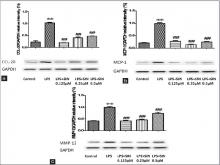  Determination effect of SIN on chemokines and metalloproteinases using Western blot analysis and normalized to GAPDH