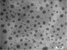 TEM observation images of Gal-SMEDDS (× 30000)