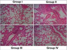 Ameliorative role of prunetin on lung histology in lung  cancer-induced mice