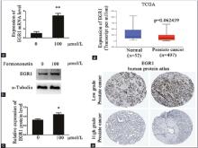 Formononetin increases EGR1 expression in DU145 and EGR1 decreases in the progression of human PCa